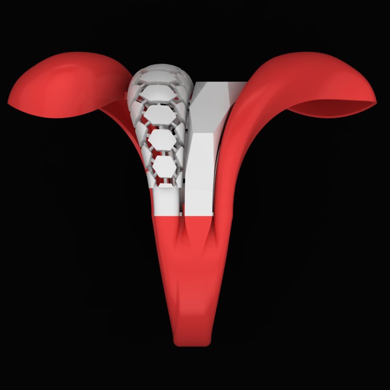 انگشتر تراش خور R-T-A-03 انگشتر تراش خور R-T-A-03